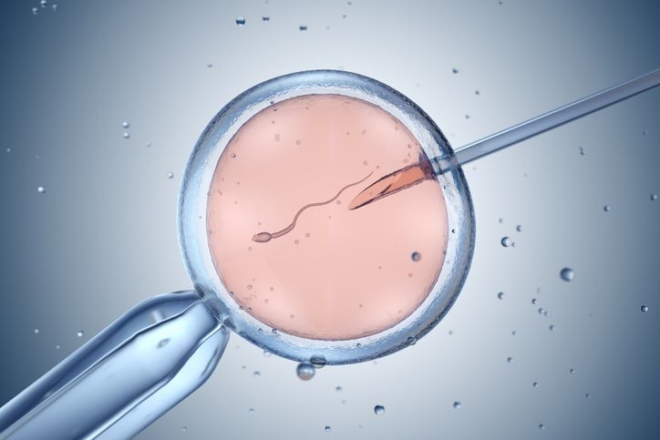 ivf laboratory punction