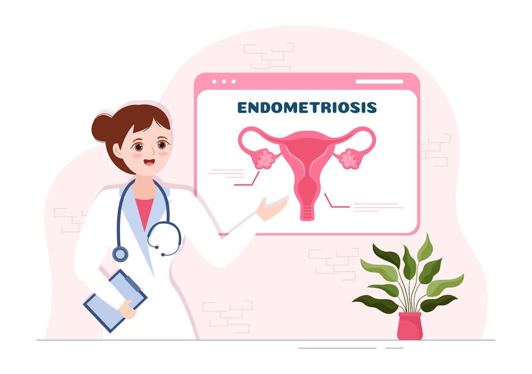 endometriosis